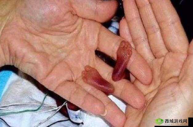 世界上最小 BB 有几个相关话题探讨